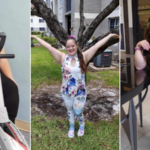 Coconut Creek Mom Advocates for Daughter with Down Syndrome, Secures Weight Loss Surgery